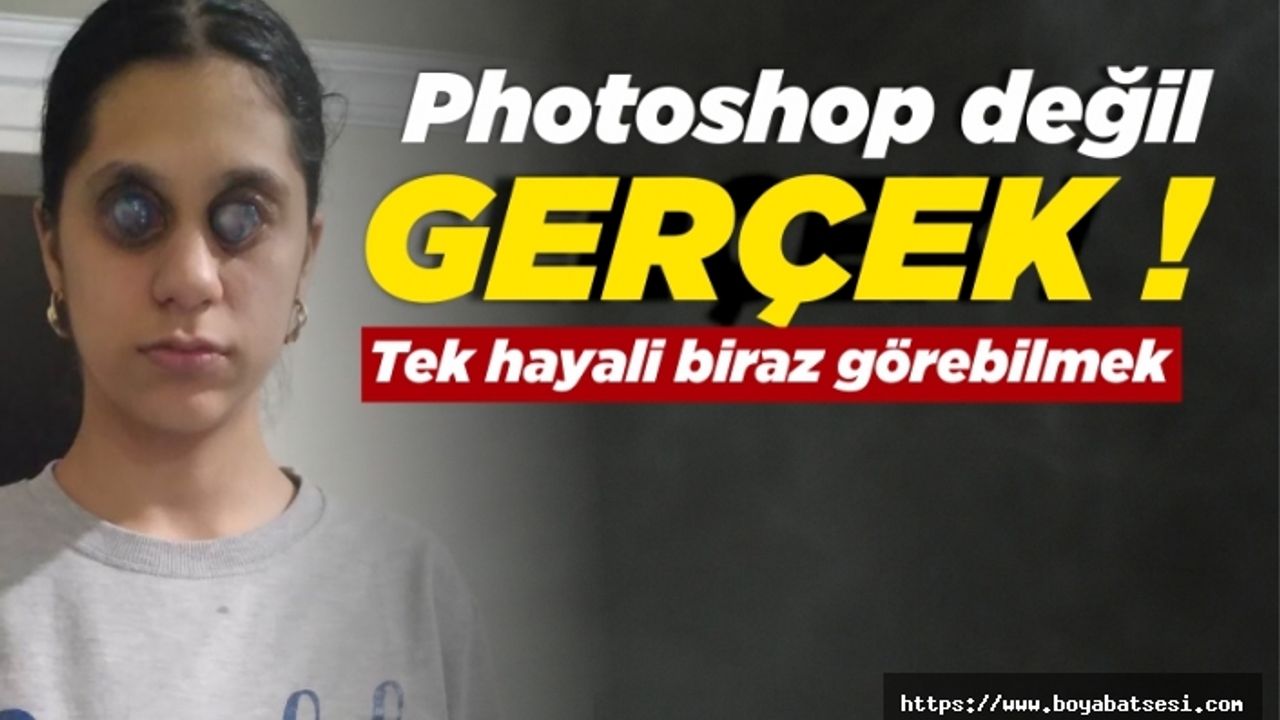 Genç Ümran'ı görenler gözlerine inanamıyor 
