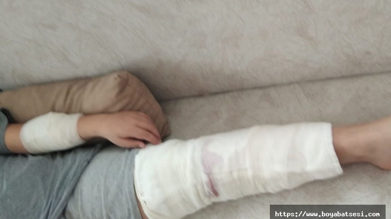 Boyabat'ta köpek saldırısına uğrayan çocuk taburcu edildi