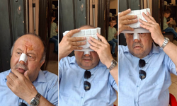 Boyabatlı Eski milletvekili kaza geçirdi