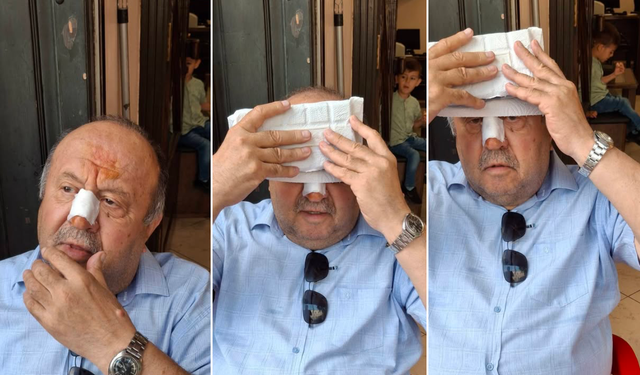 Boyabatlı Eski milletvekili kaza geçirdi