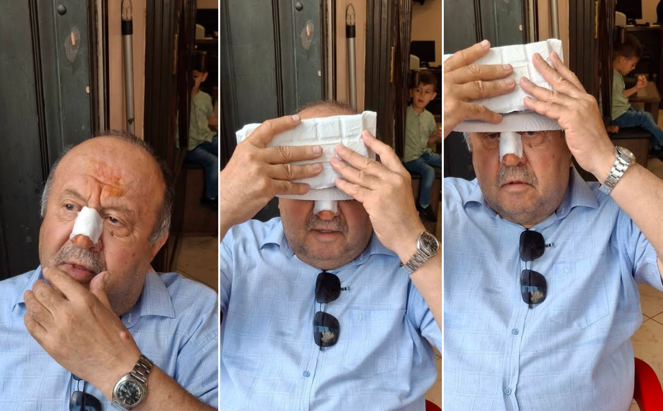 Boyabatlı Eski milletvekili kaza geçirdi